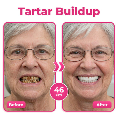 🦷 Natravor® Thismile NH-10 Nano-Hydroxyapatite Serum – Enamel Care, Gum Comfort & Whitening Support