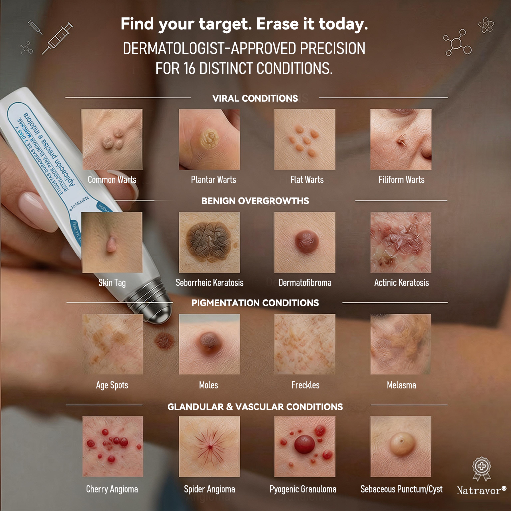 𝐎𝐟𝐟𝐢𝐜𝐢𝐚𝐥 𝐁𝐫𝐚𝐧𝐝 𝐒𝐭𝐨𝐫𝐞 |✅🎉Natravor® 7-Day Tag & Spot Eraser Rollerball | Gentle, Easy-to-Use Skin Care