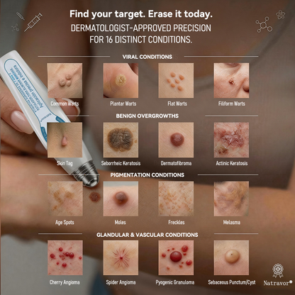 𝐎𝐟𝐟𝐢𝐜𝐢𝐚𝐥 𝐁𝐫𝐚𝐧𝐝 𝐒𝐭𝐨𝐫𝐞 |✅🎉Natravor® 7-Day Tag & Spot Eraser Rollerball | Gentle, Easy-to-Use Skin Care