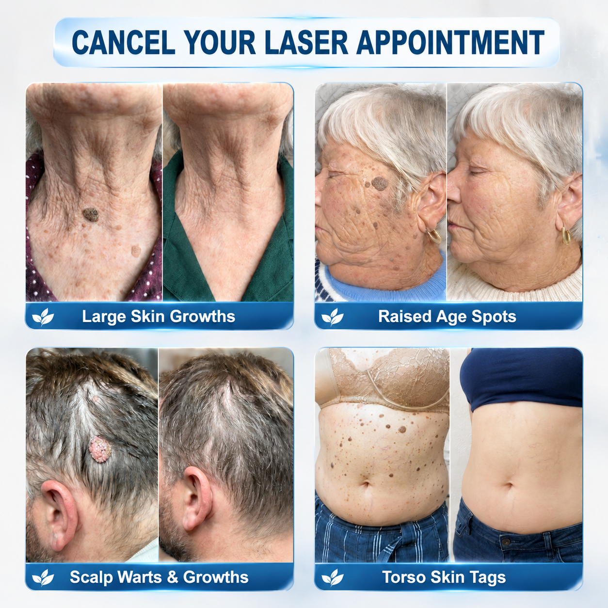 Natravor® 7-𝐃𝐚𝐲 𝐒𝐤𝐢𝐧 𝐓𝐚𝐠 & 𝐒𝐩𝐨𝐭 𝐄𝐫𝐚𝐬𝐞𝐫 𝐂𝐫𝐞𝐚𝐦 (Zero Pain, Zero 𝐒𝐜𝐚𝐫𝐬 Formula) 💎